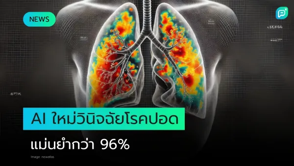 AI ตัวใหม่ตรวจพบโรคปอดได้ 97% และแยกแยะโรคปอดอักเสบกับ COVID-19 ได้